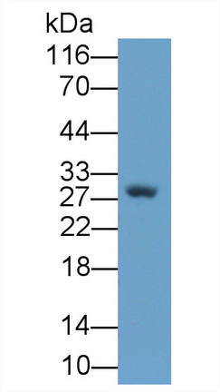 Monoclonal Antibody to Nerve Growth Factor (NGF)