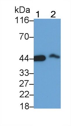 Monoclonal Antibody to Creatine Kinase, Muscle (CKM)