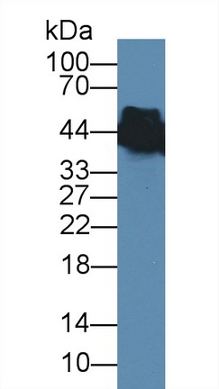 Monoclonal Antibody to Creatine Kinase, Muscle (CKM)