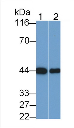 Monoclonal Antibody to Creatine Kinase, Muscle (CKM)