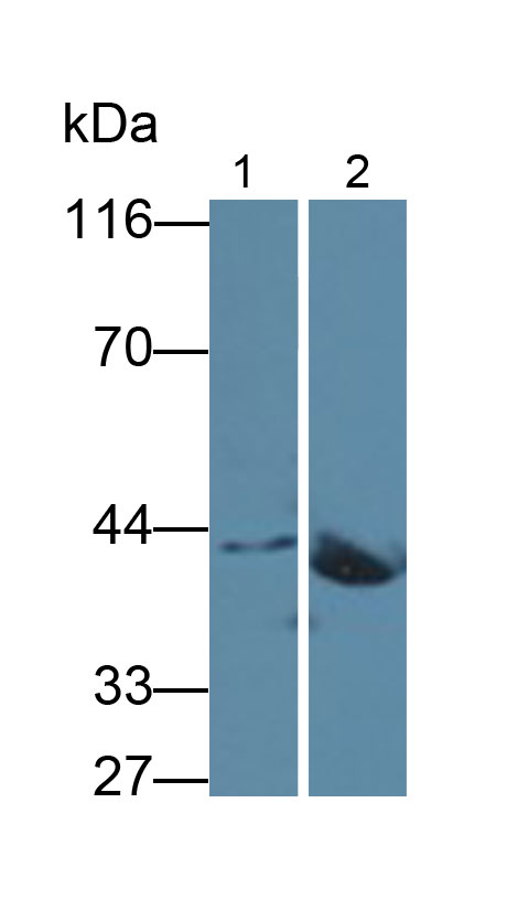 Monoclonal Antibody to Creatine Kinase, Muscle (CKM)