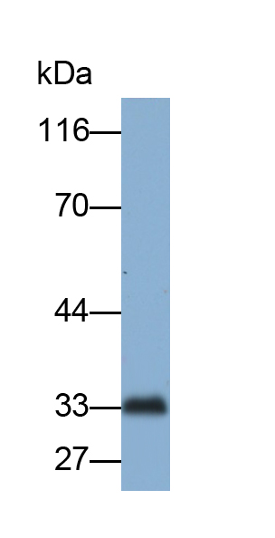 Monoclonal Antibody to Superoxide Dismutase 3, Extracellular (SOD3)