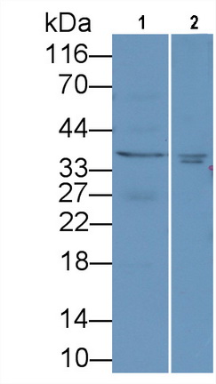 Monoclonal Antibody to Cluster Of Differentiation 40 Ligand (CD40L)