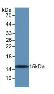 Monoclonal Antibody to Transforming Growth Factor Beta 1 (TGFb1)