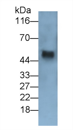 Monoclonal Antibody to Transforming Growth Factor Beta 1 (TGFb1)