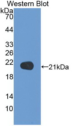 Monoclonal Antibody to Tumor Necrosis Factor Alpha (TNFa)