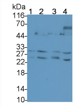 MAA139Hu23.jpg