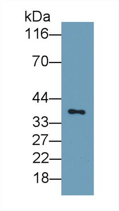 Monoclonal Antibody to Plasminogen Activator, Urokinase Receptor (uPAR)