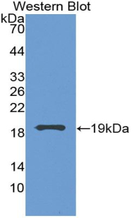 Monoclonal Antibody to Vascular Endothelial Growth Factor A (VEGFA)