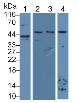 Monoclonal Antibody to Vascular Endothelial Growth Factor A (VEGFA)