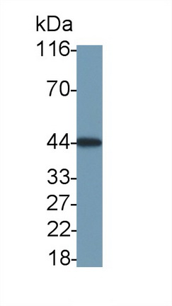 Monoclonal Antibody to Vascular Endothelial Growth Factor A (VEGFA)