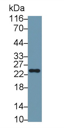 Monoclonal Antibody to Vascular Endothelial Growth Factor A (VEGFA)