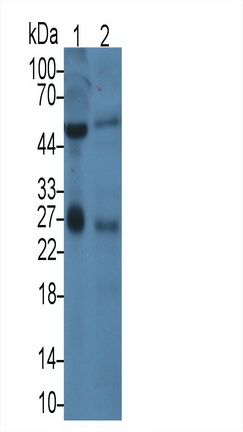 Monoclonal Antibody to Prostate Specific Antigen (PSA)