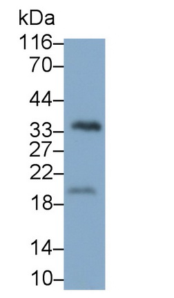 MAA151Hu23.jpg