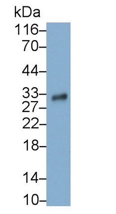 Monoclonal Antibody to Prostate Specific Antigen (PSA)