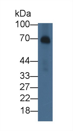 Monoclonal Antibody to Alpha-Fetoprotein (AFP)