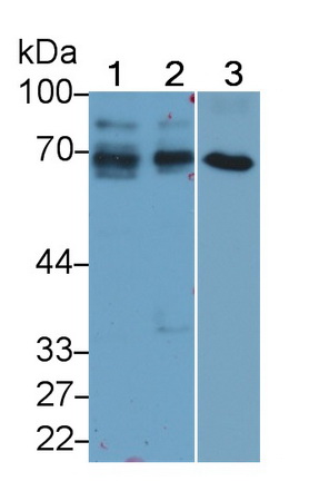 Monoclonal Antibody to Alpha-Fetoprotein (AFP)