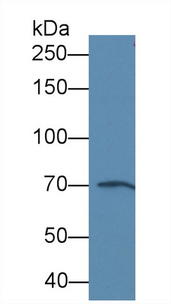 Monoclonal Antibody to Alpha-Fetoprotein (AFP)