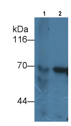 Monoclonal Antibody to Alpha-Fetoprotein (AFP)