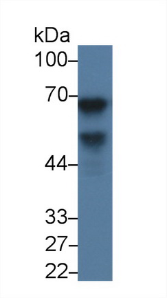 Monoclonal Antibody to Alpha-Fetoprotein (AFP)