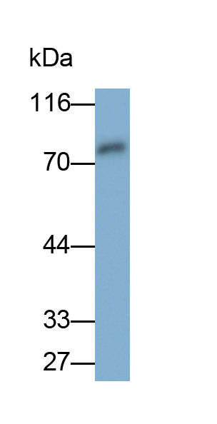 Monoclonal Antibody to Alpha-Fetoprotein (AFP)