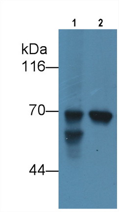 Monoclonal Antibody to Alpha-Fetoprotein (AFP)