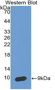 Monoclonal Antibody to Serpin Peptidase Inhibitor,Clade B,Member 4 (SERPINB4)