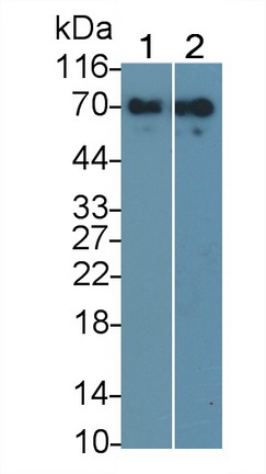 Monoclonal Antibody to Alpha 2-Antiplasmin (a2PI)