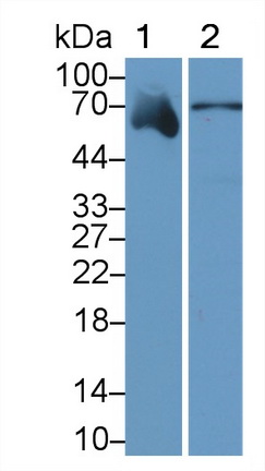 Monoclonal Antibody to Alpha 2-Antiplasmin (a2PI)