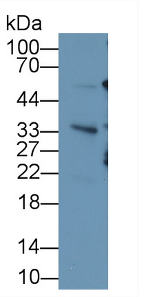 Monoclonal Antibody to Ubiquitin (Ub)