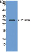 Monoclonal Antibody to Pepsinogen A (PGA)