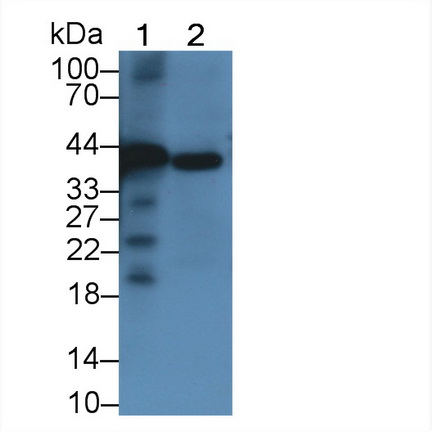 Monoclonal Antibody to Pepsinogen A (PGA)