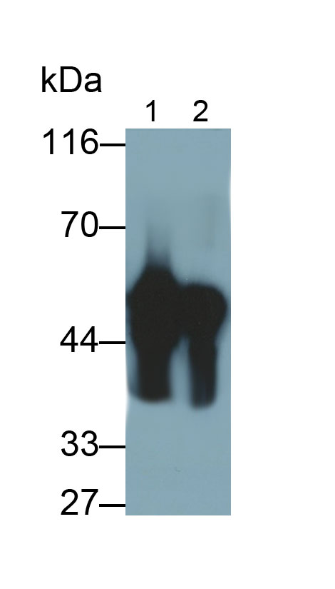 Monoclonal Antibody to Pepsinogen A (PGA)