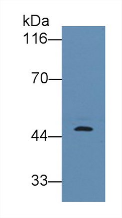 Monoclonal Antibody to Pepsinogen A (PGA)