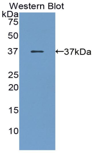 Monoclonal Antibody to Pepsinogen C (PGC)