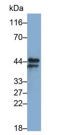 Monoclonal Antibody to Pepsinogen C (PGC)