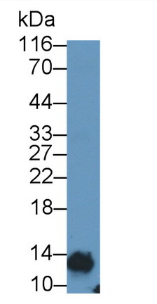 Monoclonal Antibody to Glycated Hemoglobin A1c (HbA1c)