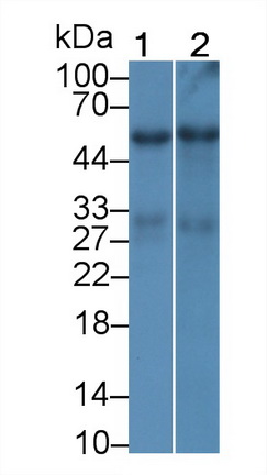 Monoclonal Antibody to Alanine Aminotransferase (ALT)