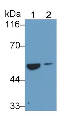 Monoclonal Antibody to Alanine Aminotransferase (ALT)