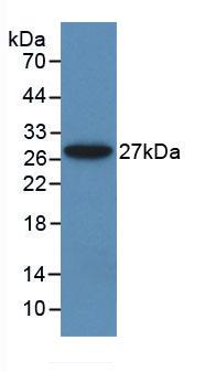 Monoclonal Antibody to Alanine Aminotransferase (ALT)