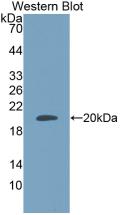 Monoclonal Antibody to Adrenomedullin (ADM)