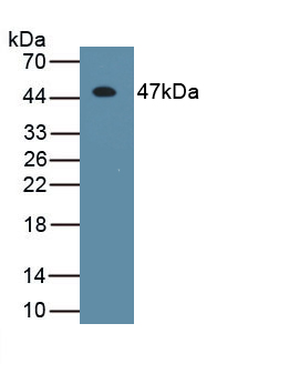 Monoclonal Antibody to Interferon Beta (IFNb)