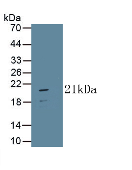 Monoclonal Antibody to Interferon Beta (IFNb)