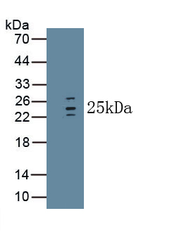 Monoclonal Antibody to Interleukin 1 Receptor Antagonist (IL1RA)