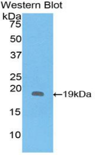 Monoclonal Antibody to Interleukin 1 Receptor Antagonist (IL1RA)