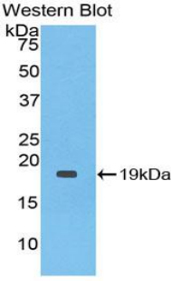Monoclonal Antibody to Interleukin 1 Receptor Antagonist (IL1RA)