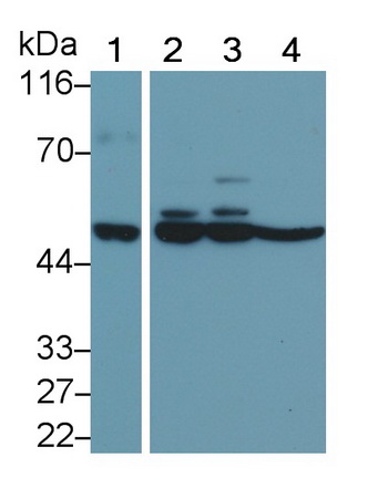 Monoclonal Antibody to Matrix Metalloproteinase 11 (MMP11)