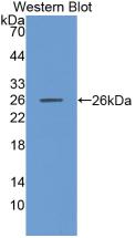 Monoclonal Antibody to Matrix Metalloproteinase 11 (MMP11)