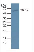 Monoclonal Antibody to Anti-Mullerian Hormone (AMH)