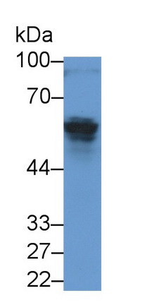 Monoclonal Antibody to Anti-Mullerian Hormone (AMH)